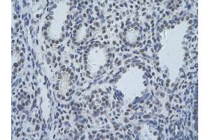 Immunohistochemistry (IHC) image for anti-Splicing Factor 3b, Subunit 1, 155kDa (SF3B1) (N-Term) antibody (ABIN2778700)