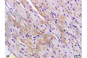 Formalin-fixed and paraffin embedded rat heart labeled with Anti-Titin/CMD1G Polyclonal Antibody, Unconjugated (ABIN1387283) at 1:200 followed by conjugation to the secondary antibody and DAB staining.