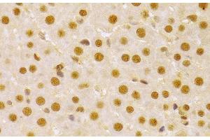 Immunohistochemistry of paraffin-embedded Rat liver using CDC25A Polyclonal Antibody at dilution of 1:100 (40x lens). (CDC25A antibody)