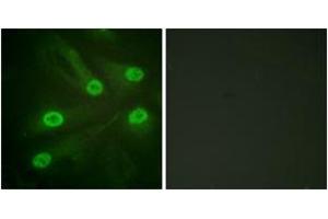 Immunofluorescence analysis of HeLa cells, using p53 (Acetyl-Lys386) Antibody. (p53 antibody  (acLys386))