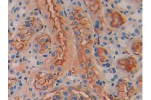 DAB staining on IHC-P; Samples: Mouse Kidney Tissue (BMP5 antibody  (AA 201-314))