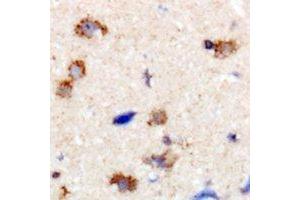 Immunohistochemical analysis of Dynamin 1 staining in human brain formalin fixed paraffin embedded tissue section. (Dynamin 1 antibody  (C-Term))