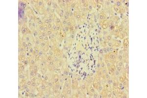 Immunohistochemistry of paraffin-embedded human liver tissue using ABIN7162471 at dilution of 1:100 (PAN2 antibody  (AA 628-908))