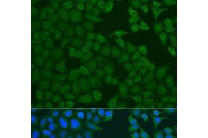Immunofluorescence analysis of U2OS cells using FERMT3 Polyclonal Antibody at dilution of 1:100.