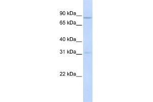 WB Suggested Anti-POMT1 Antibody Titration:  0. (POMT1 antibody  (Middle Region))