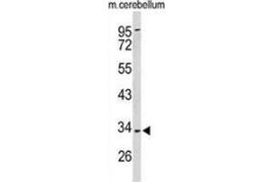 Western blot analysis of Peroxin 2 / PEX2 / RNF72 (arrow) in mouse cerebellum tissue lysates (35ug/lane) using Peroxin 2 / PEX2 / RNF72  (PEX2 antibody  (Middle Region))