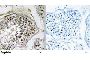 Immunohistochemistry analysis of paraffin-embedded human testis tissue using ELOVL2 polyclonal antibody . (ELOVL2 antibody)