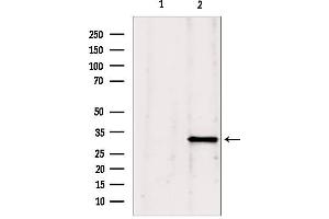 Western blot analysis of extracts from Mouse Myeloma cell, using GNMT antibody.