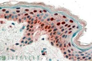 Image no. 1 for anti-Stratifin (SFN) (Internal Region), (N-Term) antibody (ABIN374638) (14-3-3 sigma/SFN antibody  (Internal Region, N-Term))