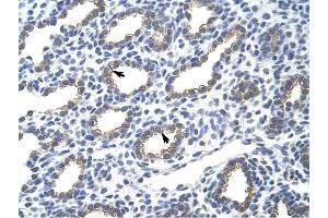 Cytokeratin 18 antibody was used for immunohistochemistry at a concentration of 4-8 ug/ml to stain Alveolar cells (arrows) in Human Lung. (Cytokeratin 18 antibody  (N-Term))
