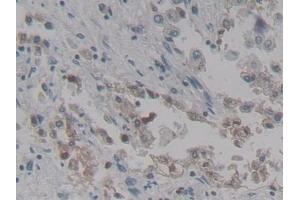 Detection of SPD in Human Lung Tissue using Polyclonal Antibody to Surfactant Associated Protein D (SPD) (SFTPD antibody  (AA 21-375))