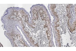 Immunohistochemistry (IHC) image for anti-Androgen Receptor (AR) (N-Term) antibody (ABIN7538841)
