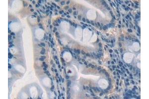 Detection of GDF5 in Human Stomach Tissue using Polyclonal Antibody to Growth Differentiation Factor 5 (GDF5) (GDF5 antibody  (AA 86-501))