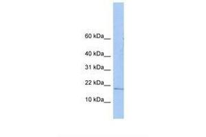 ZNHIT3 antibody  (AA 38-87)