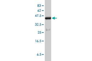 Western Blot detection against Immunogen (45. (CETN2 antibody  (AA 1-172))