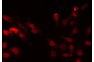 ABIN6268826 staining HepG2 by IF/ICC. (ZEB2 antibody  (N-Term))