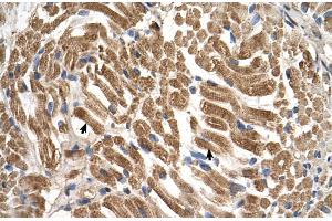 Immunohistochemistry (IHC) image for anti-Solute Carrier Family 17 (Acidic Sugar Transporter), Member 5 (SLC17A5) (N-Term) antibody (ABIN2781631)