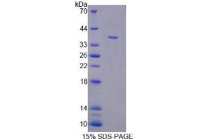 SDS-PAGE (SDS) image for Tectorin beta (TECTB) (AA 18-329) protein (His tag) (ABIN6239141)