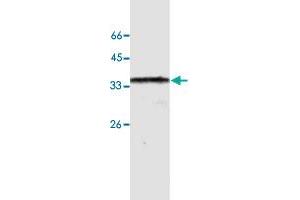 Western blot analysis of HeLa whole cell lystae with ANXA10 monoclonal antibody, clone 24  at 1:500 dilution. (Annexin a10 antibody  (AA 168-324))