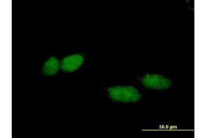 Immunofluorescence of purified MaxPab antibody to TBL1X on HeLa cell. (TBL1X antibody  (AA 1-526))