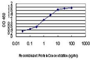 Detection limit for recombinant GST tagged ZIC4 is approximately 0. (ZIC4 antibody  (AA 249-319))