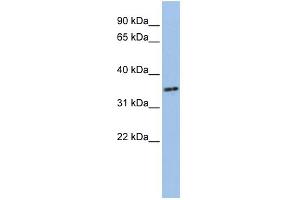 WB Suggested Anti-PHF13 Antibody Titration:  0. (PHF13 antibody  (N-Term))