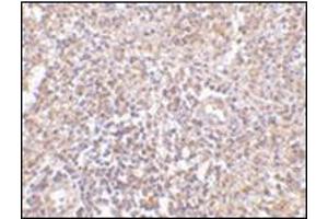 Immunohistochemistry of RAP80 in human spleen tissue with this product at 2. (UIMC1 antibody  (N-Term))