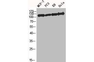 Western Blot analysis of MCF7 PC-3 KB HELA cells using BM28 Polyclonal Antibody (MCM2 antibody  (N-Term))
