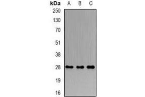 Western blot analysis of PRDX4 expression in Hela (A), MCF7 (B), mouse testis (C) whole cell lysates. (Peroxiredoxin 4 antibody)