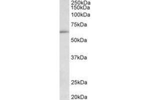 Image no. 1 for anti-Hypermethylated in Cancer 2 (HIC2) (AA 188-200) antibody (ABIN1102028)
