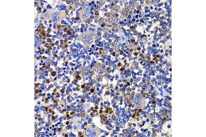 Immunohistochemistry of paraffin-embedded rat spleen using STAMBP antibody at dilution of 1:100 (x400 lens). (STAMBP antibody)