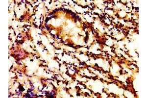 IHC image of ABIN7154307 diluted at 1:500 and staining in paraffin-embedded human appendix tissue performed on a Leica BondTM system.