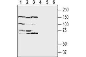 Western blot analysis of human MCF-7 breast adenocarcinoma cell line lysate (lanes 1 and 4), human U-87 MG glioblastoma cell line lysate (lanes 2 and 5) and human THP-1 monocytic leukemia cell line lysate (lanes 3 and 6): - 1-3. (IGF1R antibody  (Extracellular, N-Term))
