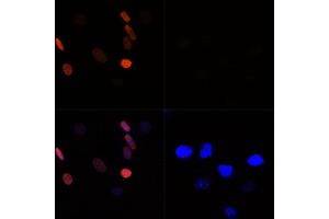 Immunofluorescence analysis of NIH/3T3 cells using Acetyl-Histone H3-K56 Rabbit pAb (ABIN7267674) at dilution of 100 (40x lens). (Histone 3 antibody  (H3K56))