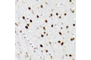 Immunohistochemistry of paraffin-embedded rat brain using S Rabbit pAb (ABIN6130296, ABIN6147396, ABIN6147398 and ABIN6221485) at dilution of 1:200 (40x lens). (SATB1 antibody  (AA 484-763))