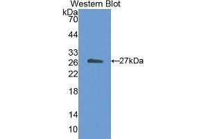 Western Blotting (WB) image for anti-Cholesteryl Ester Transfer Protein (CETP) (AA 81-311) antibody (ABIN1173657)