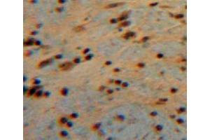Used in DAB staining on fromalin fixed paraffin-embedded brain tissue (CNTF antibody  (AA 2-200))