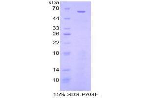 SDS-PAGE analysis of Mouse Nestin Protein. (Nestin Protein (NES))
