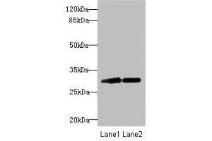 Western blot All lanes: TRIM69 antibody at 2.