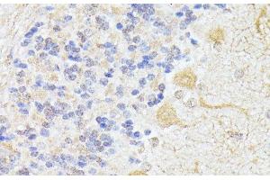 Immunohistochemistry of paraffin-embedded Rat cerebellum using ELP3 Polyclonal Antibody at dilution of 1:100 (40x lens). (ELP3/KAT9 antibody)