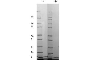 SDS-PAGE of Mouse Gro-alpha /KC (CXCL1) Recombinant Protein SDS-PAGE of Mouse Gro-alpha /KC (CXCL1) Recombinant Protein. (CXCL1 Protein)