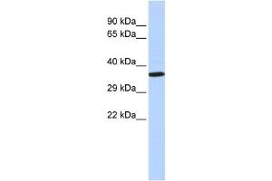 WB Suggested Anti-NKX2-2 Antibody Titration:  0. (Nkx2-2 antibody  (N-Term))