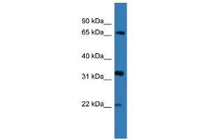 WB Suggested Anti-DOK4 Antibody Titration: 0. (DOK4 antibody  (N-Term))