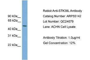 WB Suggested Anti-STK38L  Antibody Titration: 0. (STK38L antibody  (Middle Region))
