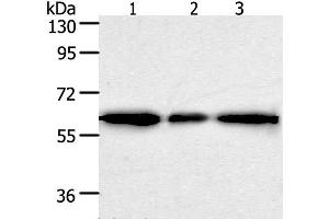 Western Blot analysis of Human liver cancer tissue, hela and 293T cell using AKR1A1 Polyclonal Antibody at dilution of 1:500 (AKR1A1 antibody)