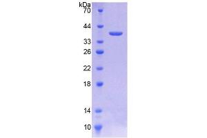 SDS-PAGE (SDS) image for Desmoglein 2 (DSG2) (AA 275-533) protein (His tag) (ABIN4989060) (Desmoglein 2 Protein (DSG2) (AA 275-533) (His tag))