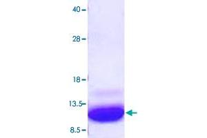 Image no. 1 for S100 Calcium Binding Protein A1 (S100A1) (AA 1-94) protein (His tag) (ABIN5570660) (S100A1 Protein (AA 1-94) (His tag))