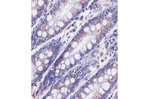 staining BPC3 in human colon tissue sections by Immunohistochemistry (IHC-P - raformaldehyde-fixed, raffin-embedded sections).