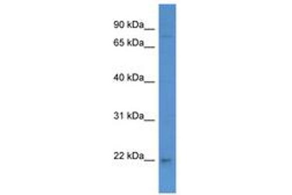 PYM antibody  (C-Term)