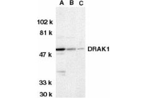 Image no. 1 for anti-serine/threonine Kinase 17a (STK17A) (AA 5-19) antibody (ABIN203102) (STK17A antibody  (AA 5-19))